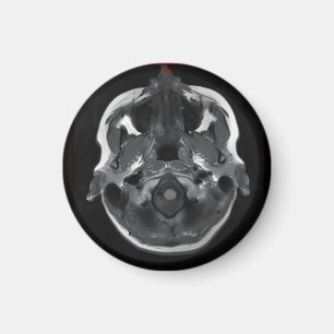 im Kopf xray mri scannen medizinisch Magnet