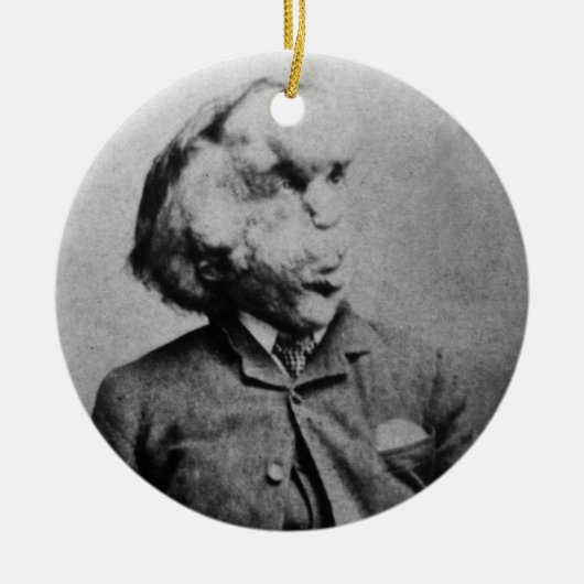 Joseph "John" Merrick Der Elefantenmann von 1889 Keramikornament (Vorne)