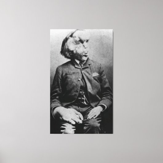 Joseph "John" Merrick Der Elefantenmann von 1889 Leinwanddruck (Vorderseite)