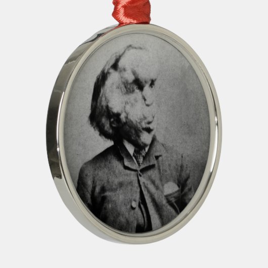 Joseph "John" Merrick Elephant Man ab 1889 Ornament Aus Metall (Rechts)