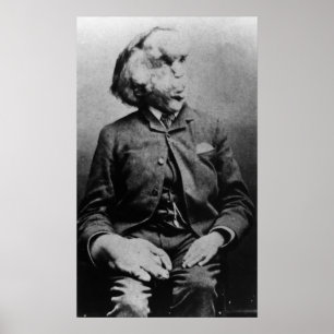Joseph "John" Merrick Elephant Man ab 1889 Poster