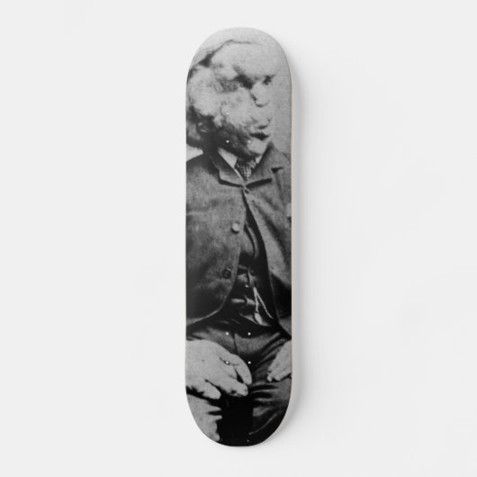 Joseph "John" Merrick Elephant Man ab 1889 Skateboard (Vorderseite)