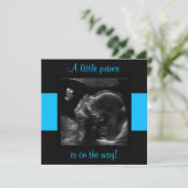 Junge Baby angepasste Ultraschallfoto-Vorlage Einladung (Stehend Vorderseite)