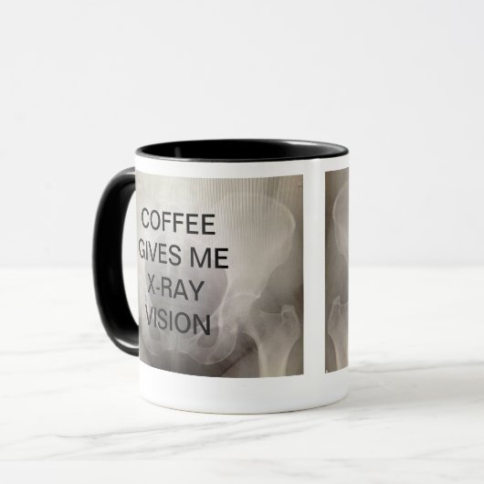 KAFFEE GIBT MIR RÖNTGENBLICK TASSE (Vorderseite Links)