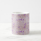 Kaffee-Tasse - chronische Myeloid Leukämie (CML) Kaffeetasse (Mittel)