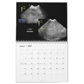 Kalender der Ultraschallbilder (Mär 2027)