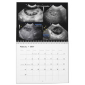 Kalender der Ultraschallbilder (Feb 2027)