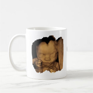 Kann nicht warten, um dich mit dem Daddy Sonogram  Kaffeetasse
