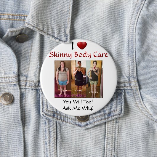 kayla Knopf Button (Beispiel)