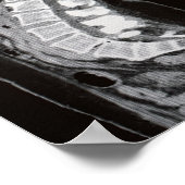 Kernspintomographie Poster (Ecke)