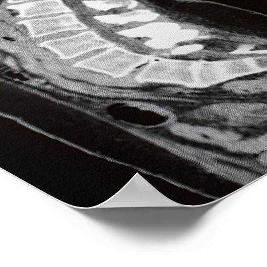 Kernspintomographie Poster (Ecke)