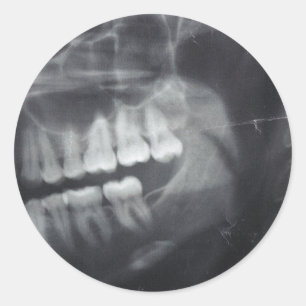 Kiefer-Aufkleber Runder Aufkleber