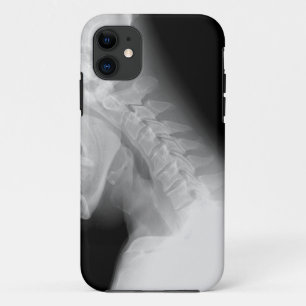 Kiefer-und des Dorn-X Strahl IPhone Fall 11 Hülle