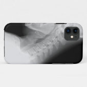 Kiefer-und des Dorn-X Strahl IPhone Fall Case-Mate iPhone Hülle (Rückseite (Horizontal))