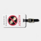 Kinderkundenspezifische Erdnuss-Allergie Gepäckanhänger (Vorderseite horizontal)