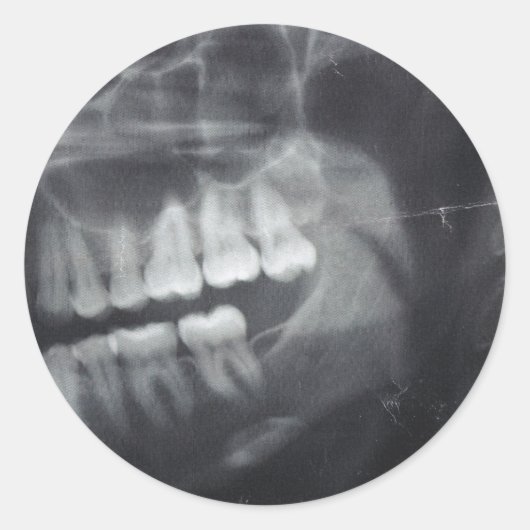 Kleber Runder Aufkleber (Vorderseite)