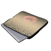 Kleine Foil-Confetty oder Diamant, Lippen Personal Laptopschutzhülle (Vorne Knopf)
