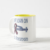 Klemmen Sie unten auf Gehirn-Aneurysma Tasse fest (Vorderseite Links)