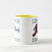 Klemmen Sie unten auf Gehirn-Aneurysma Tasse fest (Mittel)