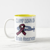 Klemmen Sie unten auf Gehirn-Aneurysma Tasse fest (Links)
