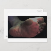 KLICKEN SIE AUF MEINE SOLE POSTKARTE (Vorne/Hinten)