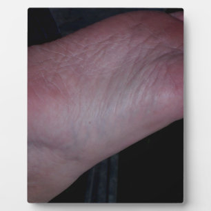 KLICKEN SIE JETZT AUF MEINEN FUSS! FOTOPLATTE