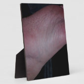 KLICKEN SIE JETZT AUF MEINEN FUSS! FOTOPLATTE (Seite)