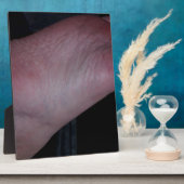 KLICKEN SIE JETZT AUF MEINEN FUSS! FOTOPLATTE (Seite)