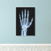 Klinisches Röntgenbild der Hand Leinwanddruck (Insitu (Holzboden))