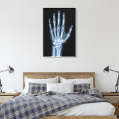 Klinisches Röntgenbild der Hand Leinwanddruck (Insitu (Schlafzimmer))