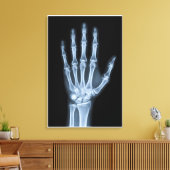 Klinisches Röntgenbild der Hand Leinwanddruck (Insitu (Wohnzimmer))