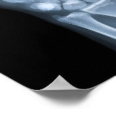 Klinisches Röntgenbild der Hand Poster (Ecke)