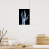 Klinisches Röntgenbild der Hand Poster (Küche)