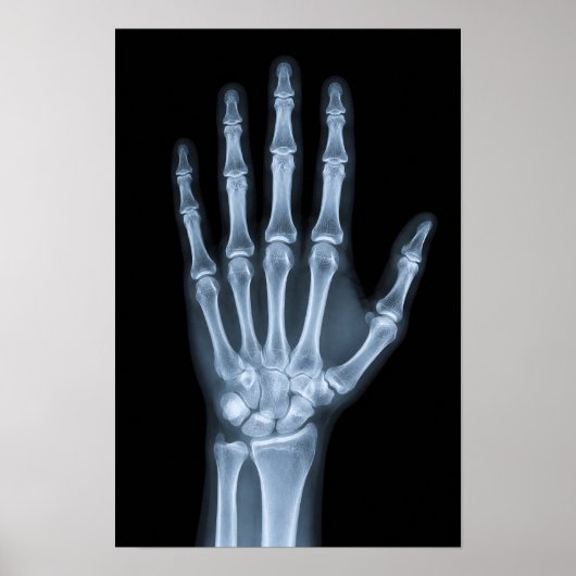Klinisches Röntgenbild der Hand Poster (Vorne)