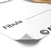 Kniegelenk Anatomie beschriftet Diagramm. Poster (Ecke)