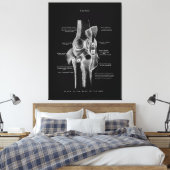 Kniegelenke Anatomie Kunst Leinwanddruck (Insitu (Schlafzimmer))