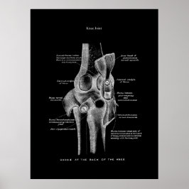 Kniegelenke Anatomie Kunst Poster
