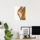 Kniegelenksersatz. Farbige Röntgenaufnahme eines g Poster (Heimbüro)