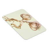 Knoblauch 2005 magnet (Rechte Seite)