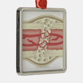 Knochen, der 2 sich repariert ornament aus metall (Rechts)