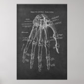 Knochen der Links Hand Palmar Oberflächenanatomie Poster (Vorne)