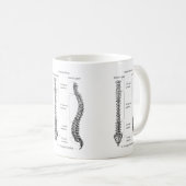 Knochen der Pelvis Kaffeetasse (VorderseiteRechts)