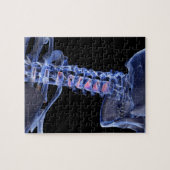 Knochen des Hals 3 Puzzle (Horizontal)