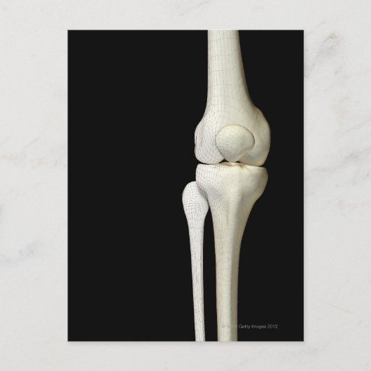 Knochen des Knies 4 Postkarte (Vorderseite)