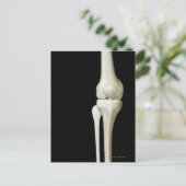 Knochen des Knies 4 Postkarte (Stehend Vorderseite)