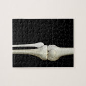 Knochen des Knies 4 Puzzle (Horizontal)