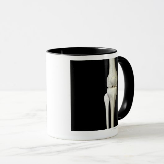 Knochen des Knies 4 Tasse (VorderseiteRechts)