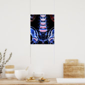 Knochen des unteren Rückens 5 Poster (Küche)