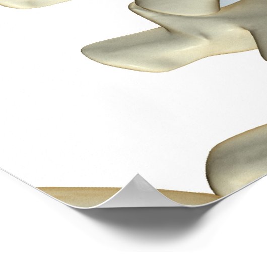Knochen von Lumbar Vertebrae Poster (Ecke)