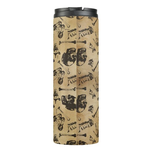 Knochenanatomie Thermosbecher (Rückseite)